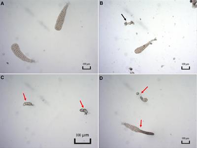 Divergence of epibacterial community assemblage correlates with malformation disease severity in Saccharina japonica seedlings